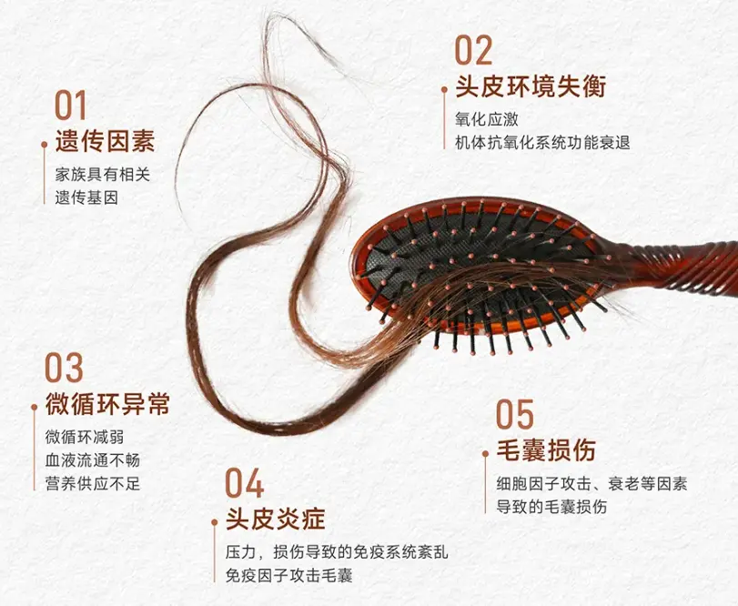 脱发原因.webp